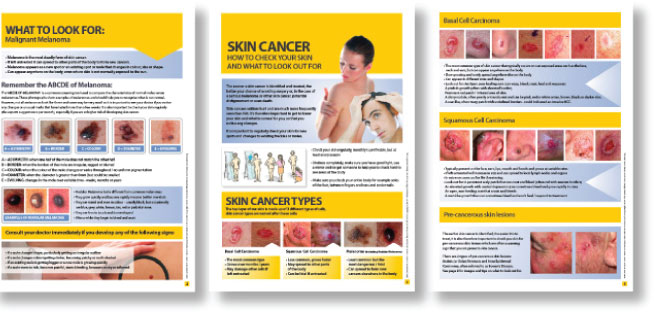 Skcin Leaflets