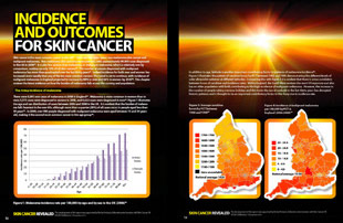 Incidence and outcomes for Skin Cancer